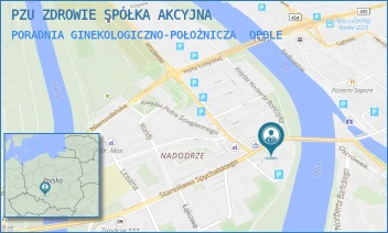 PORADNIA GINEKOLOGICZNO-POŁOŻNICZA - PZU ZDROWIE SPÓŁKA AKCYJNA - UL. PL.PIŁSUDSKIEGO 5,  OPOLE