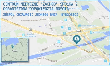 ZESPÓŁ CHIRURGII JEDNEGO DNIA - CENTRUM MEDYCZNE "ZACHÓD" SPÓŁKA Z OGRANICZONĄ ODPOWIEDZIALNOŚCIĄ - GRUNWALDZKA 138,  BYDGOSZCZ