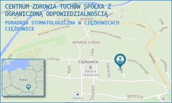 PORADNIA STOMATOLOGICZNA W CIĘŻKOWICACH - CENTRUM ZDROWIA TUCHÓW SPÓŁKA Z OGRANICZONĄ ODPOWIEDZIALNOŚCIĄ - UL. ZDROWA 1,  CIĘŻKOWICE