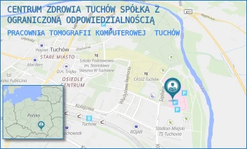 PRACOWNIA TOMOGRAFII KOMPUTEROWEJ - CENTRUM ZDROWIA TUCHÓW SPÓŁKA Z OGRANICZONĄ ODPOWIEDZIALNOŚCIĄ - UL. SZPITALNA 1,  TUCHÓW