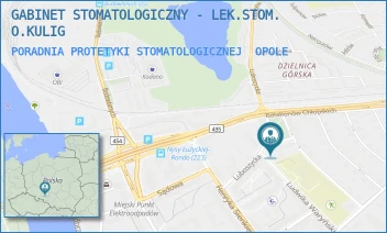 PORADNIA PROTETYKI STOMATOLOGICZNEJ - GABINET STOMATOLOGICZNY - LEK.STOM. O.KULIG - UL. LUDWIKA WARYŃSKIEGO 30,  OPOLE