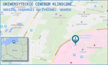 ODDZIAŁ CHIRURGII NACZYNIOWEJ - UNIWERSYTECKIE CENTRUM KLINICZNE - MARIANA SMOLUCHOWSKIEGO 17,  GDAŃSK