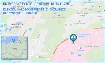 KLINIKA KARDIOCHIRURGII I CHIRURGII NACZYNIOWEJ - UNIWERSYTECKIE CENTRUM KLINICZNE - MARIANA SMOLUCHOWSKIEGO 17,  GDAŃSK