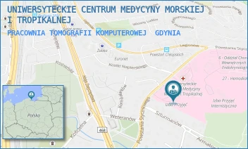 PRACOWNIA TOMOGRAFII KOMPUTEROWEJ - UNIWERSYTECKIE CENTRUM MEDYCYNY MORSKIEJ I TROPIKALNEJ - UL. POWSTANIA STYCZNIOWEGO 9B,  GDYNIA