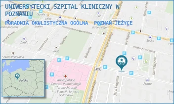PORADNIA OKULISTYCZNA OGÓLNA - UNIWERSYTECKI SZPITAL KLINICZNY W POZNANIU - AUGUSTYNA SZAMARZEWSKIEGO 84,  POZNAŃ-JEŻYCE